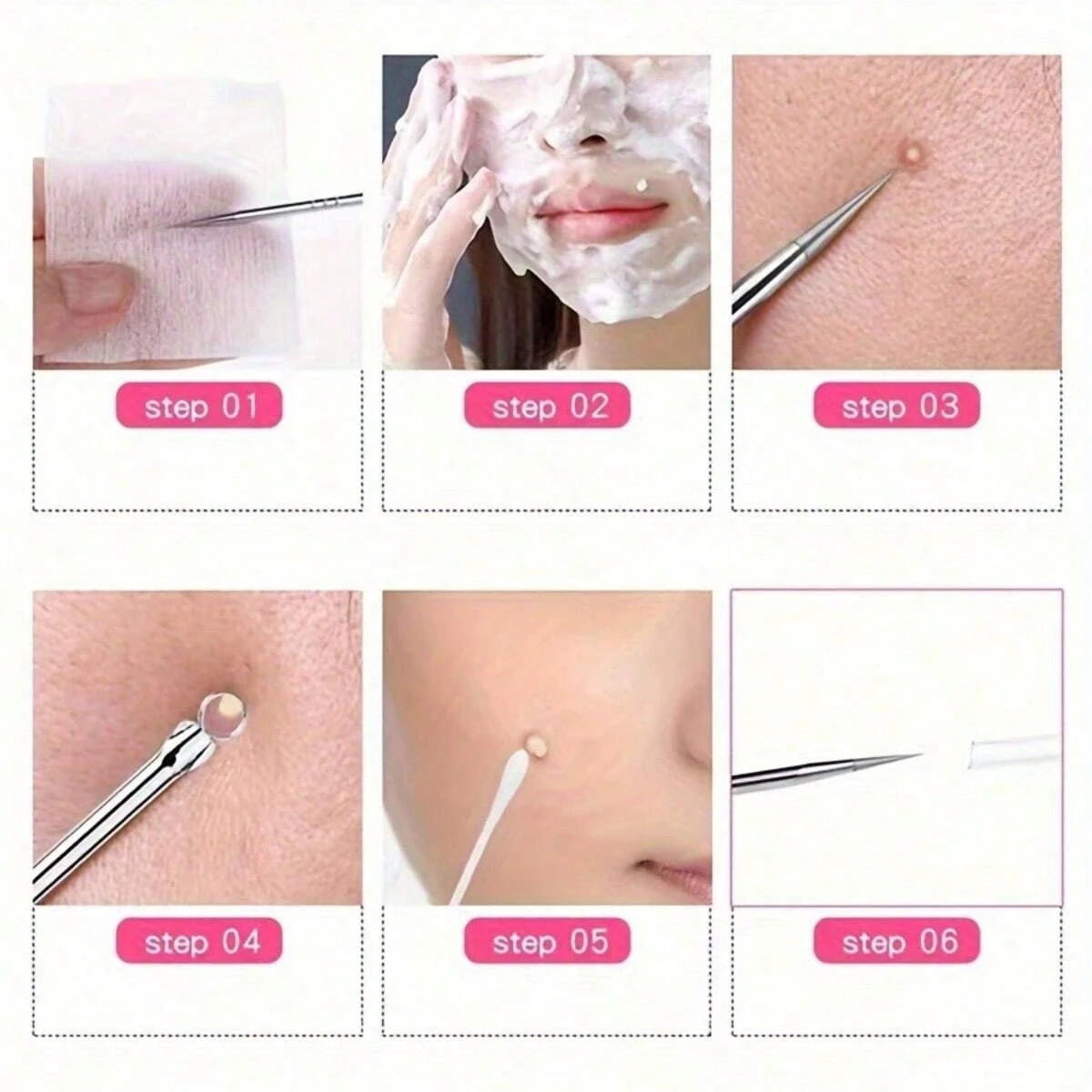 1pc Stainless Steel Blackhead Remover Tool Set- Dual-Head Blackhead Extractor Set- Fragrance-Free Acne Removal Device For Neutral Skin- Acne & Blemish Removal Tool (1 Set) Face Cleansing, Facial Br