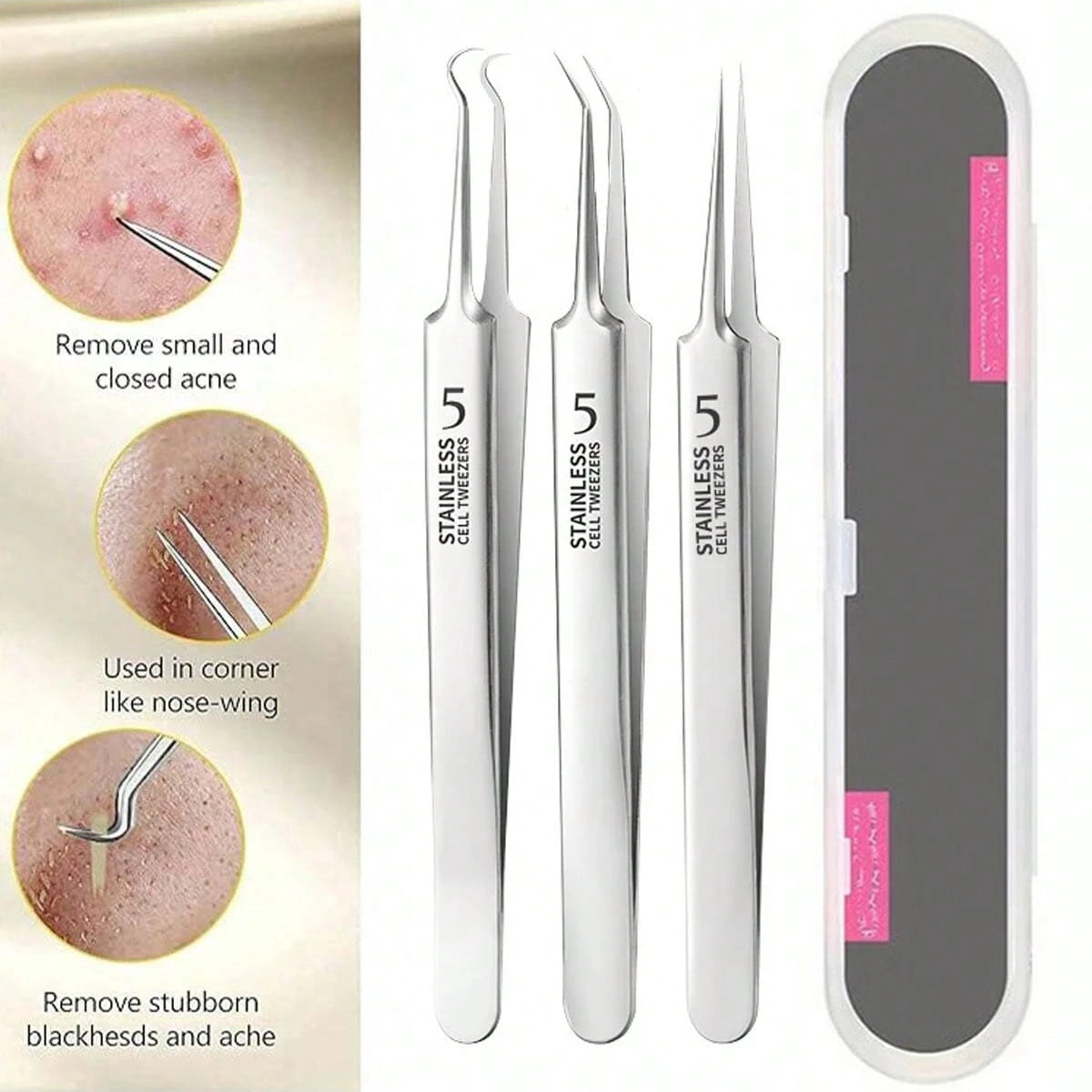 5mm Ultra Fine Blackhead Tweezers- Facial Beauty Acne Removal Tool For Skin Care